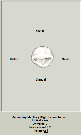 Ext Morph Mx Lateral Incisal 1.png